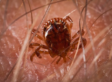 Powassan Virus and Lyme Disease